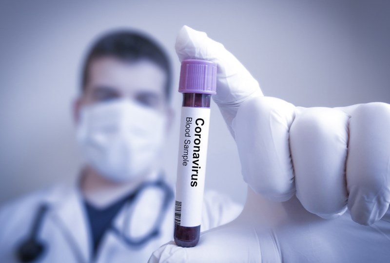 coronavirus-blood-sample-vial