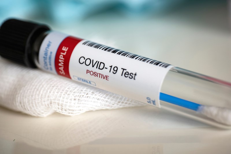 covid-19-swab-test-positive