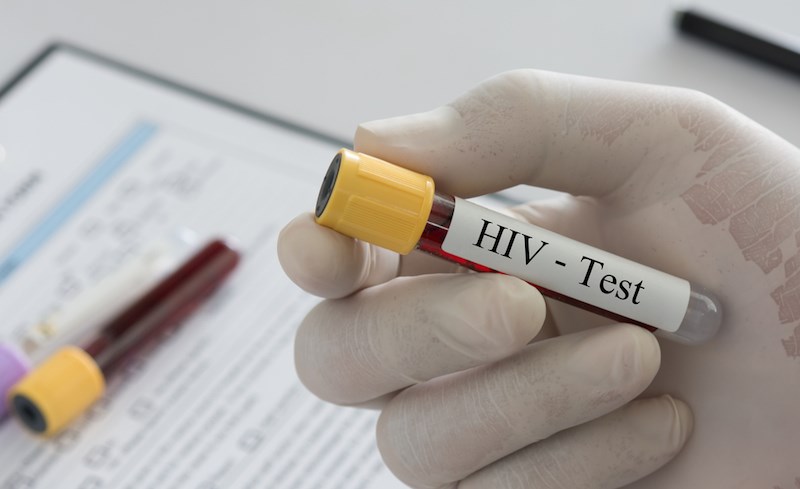 hiv-test-blood-vial
