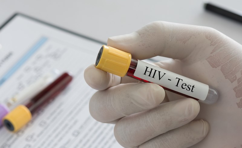 hiv-test-blood-vial