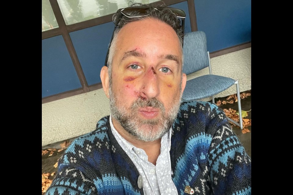 Jeff Lieberman is now recovering in Vancouver before flying back to New York.