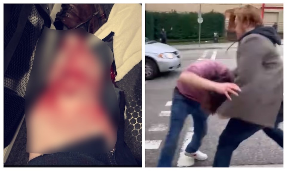 man-speaks-out-after-stabbing-vancouver