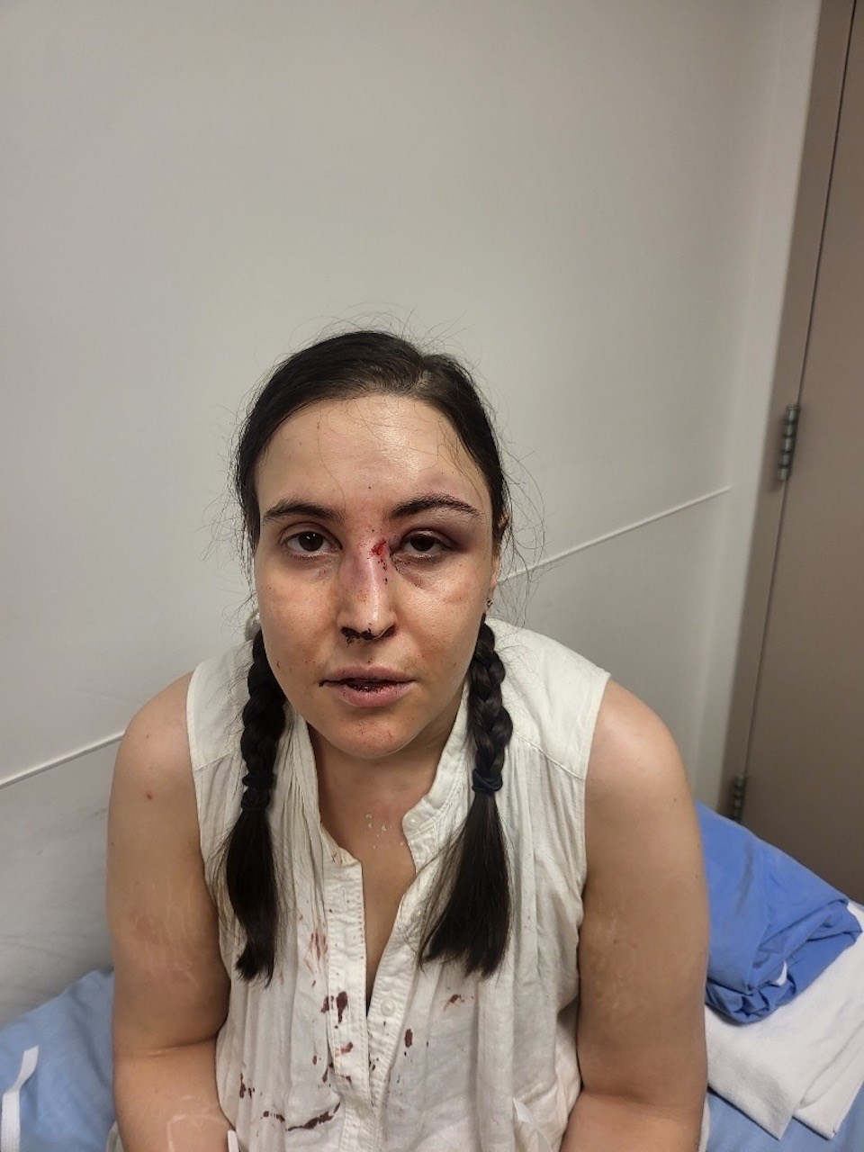 woman-assaulted-vancouver