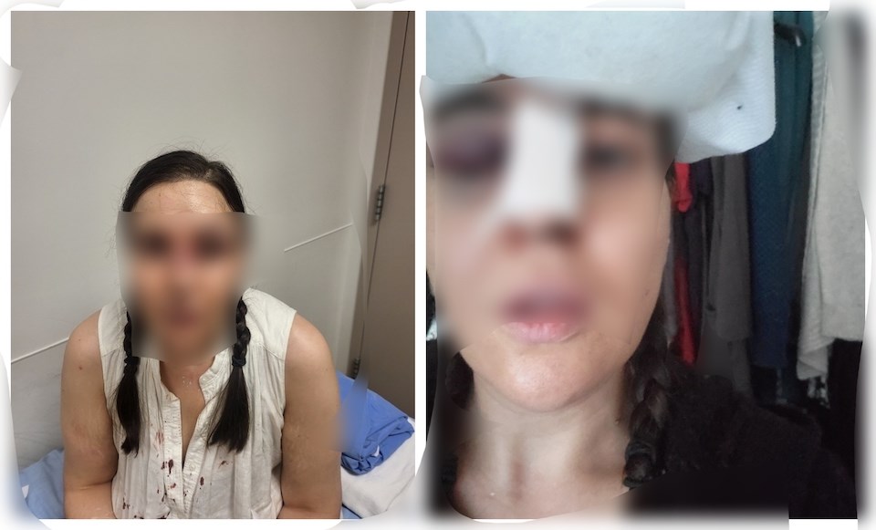 woman-assaulted-vancouver-kitsilano