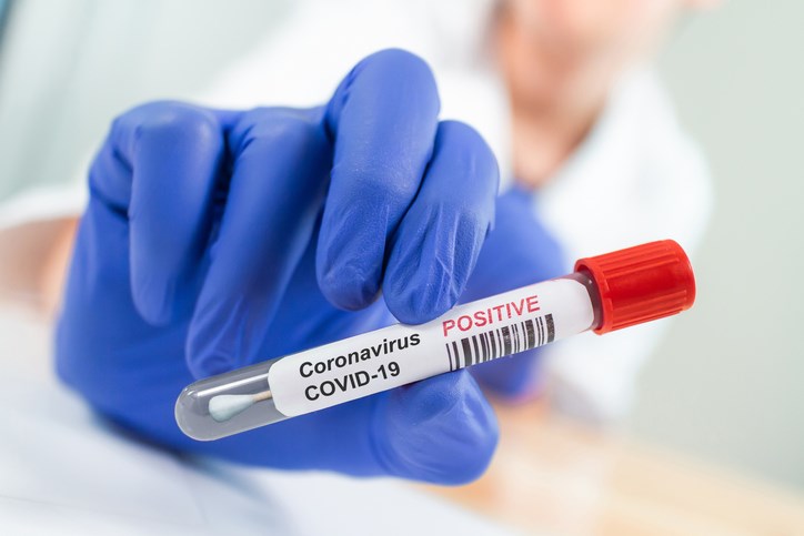A positive swab test for COVID-19. Photo: Getty Images