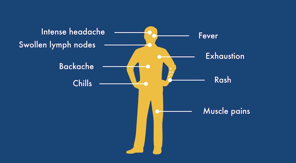 Residents of Metro Vancouver should stay home if they are ill but monkeypox symptoms may be confused with viruses such as coronavirus and the flu in 2022.