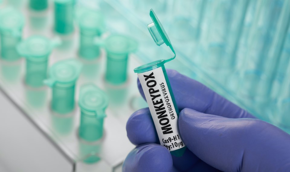 monkeypox-virus-laboratory-sample