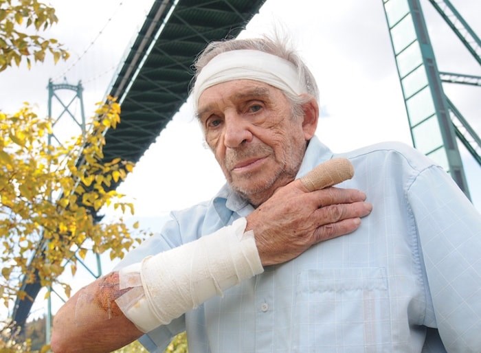  Gary Cuthbert, an 82-year-old West Vancouver man, lost a finger tip and has a long road to recovery after being attacked by an off-leash dog under the Lions Gate Bridge Friday afternoon. (Mike Wakefield/North Shore News)