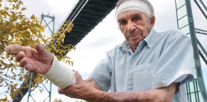  Gary Cuthbert, an 82-year-old West Vancouver man, stands under the Lions Gate Bridge where he was attacked by a dog last Friday. The dog has since been destroyed. (Mike Wakefield/North Shore News)