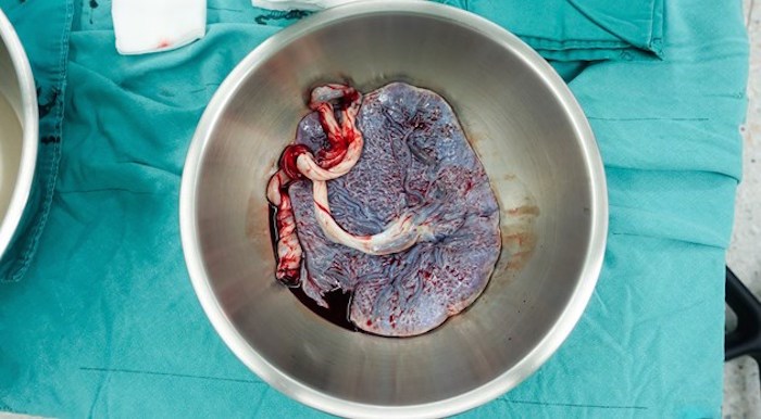  Placenta/Shutterstock