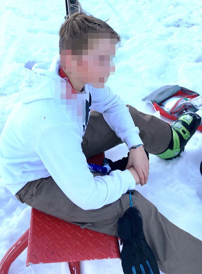  13-year-old Max Kier after being struck in the head with a ski pole at Grouse Mountain. Police are looking for witnesses