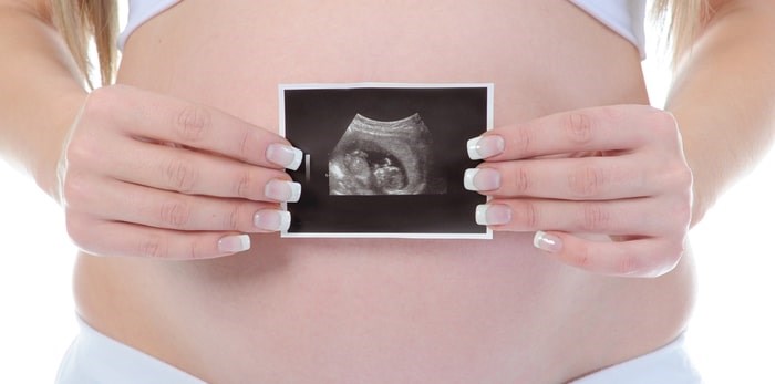  A pregnant woman holds a sonogram/Shutterstock