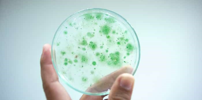  Photo: Colony of blue green algae in culture medium plate / Shutterstock