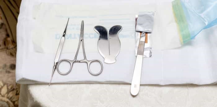  Photo: Tools for circumcision / Shutterstock