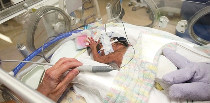  Baby Kamila gets a feeding of breast milk at the Royal Columbian neonatal intensive care unit. Photo: Cornelia Naylor