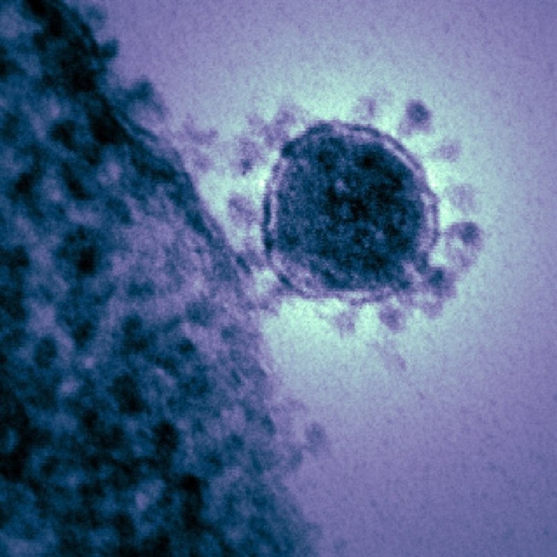 coronavirus070376-high-jpg