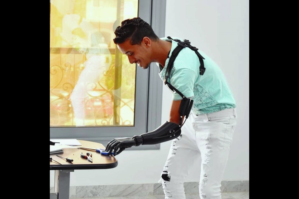 Mostafa, a client from Egypt, practises picking up a pair of scissors with his new prosthetic hand.  VIA THE HAND PROJECT  