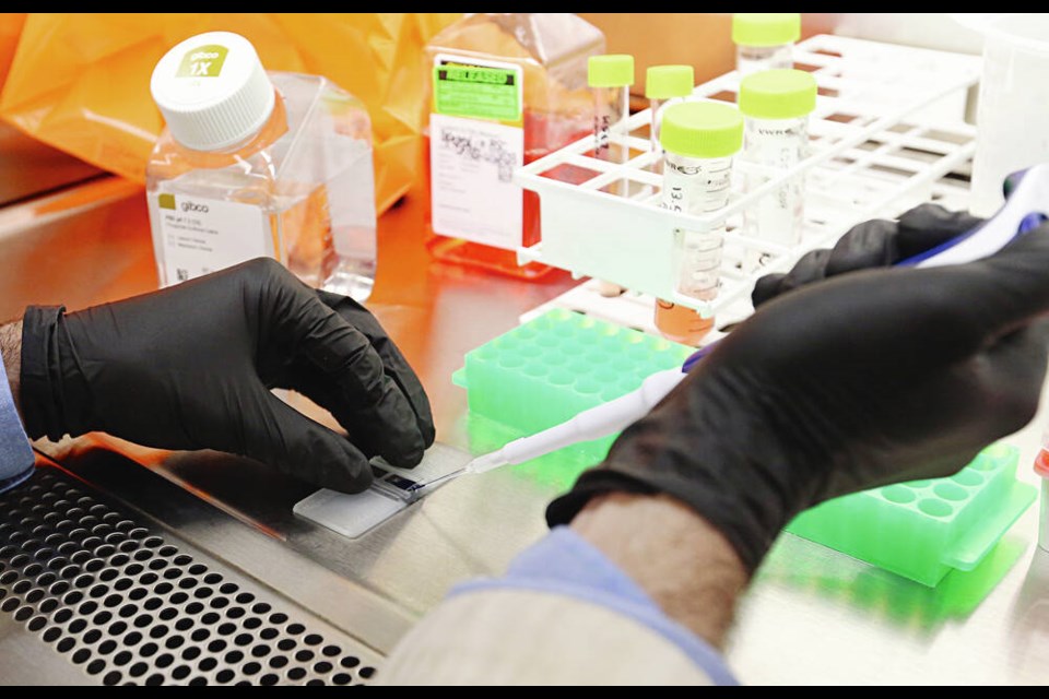 Manufacturing technician Tyler Dyer works on counting the CAR-T cells under a microscope, at the B.C. Cancer Immunotherapy Lab at Royal Jubilee Hospital. ADRIAN LAM, TIMES COLONIST  