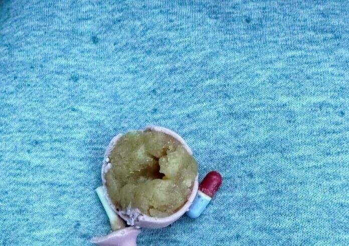web1_cake-pop-incident-at-starbucks-696x490